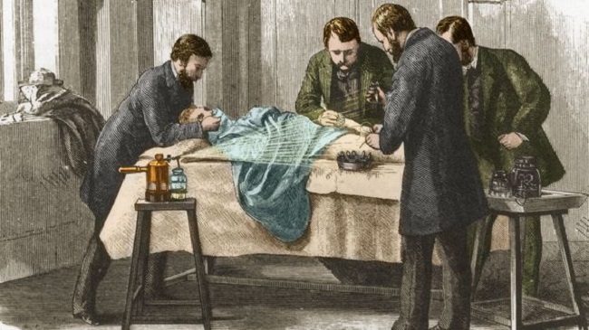 The Butchering Art: Joseph Lister's Quest to Transform The Grisly World of Victorian Medicine